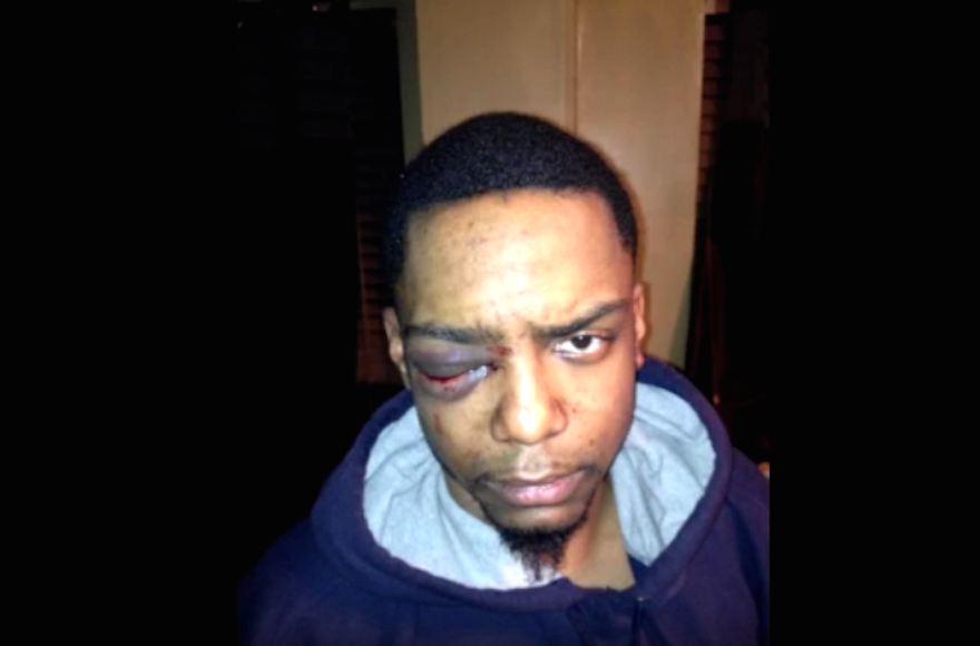 Taj Patterson was allegedly beaten by a group of Hasidic Jews, in Williamsburg, Brooklyn in 2013. (Screenshot from YouTube)