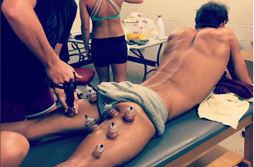 Michael Phelps receiving a cupping treatment. (Screenshot from Instagram)