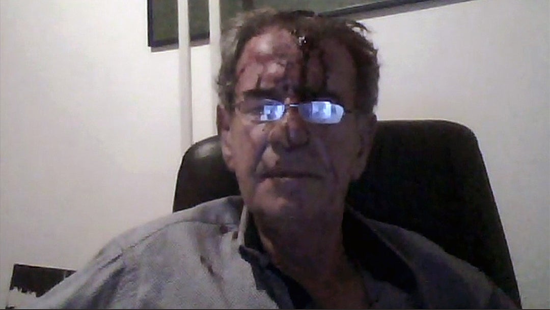 Dutch-Jewish Tob Cohen after a fight with his wife in 2019 near Nairobi, Kenya. (Courtesy of the family)