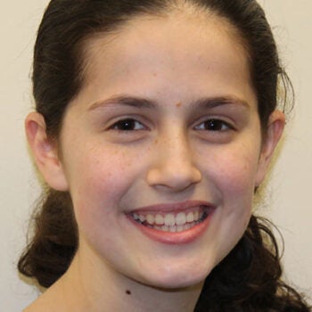 Estee Ackerman, 14